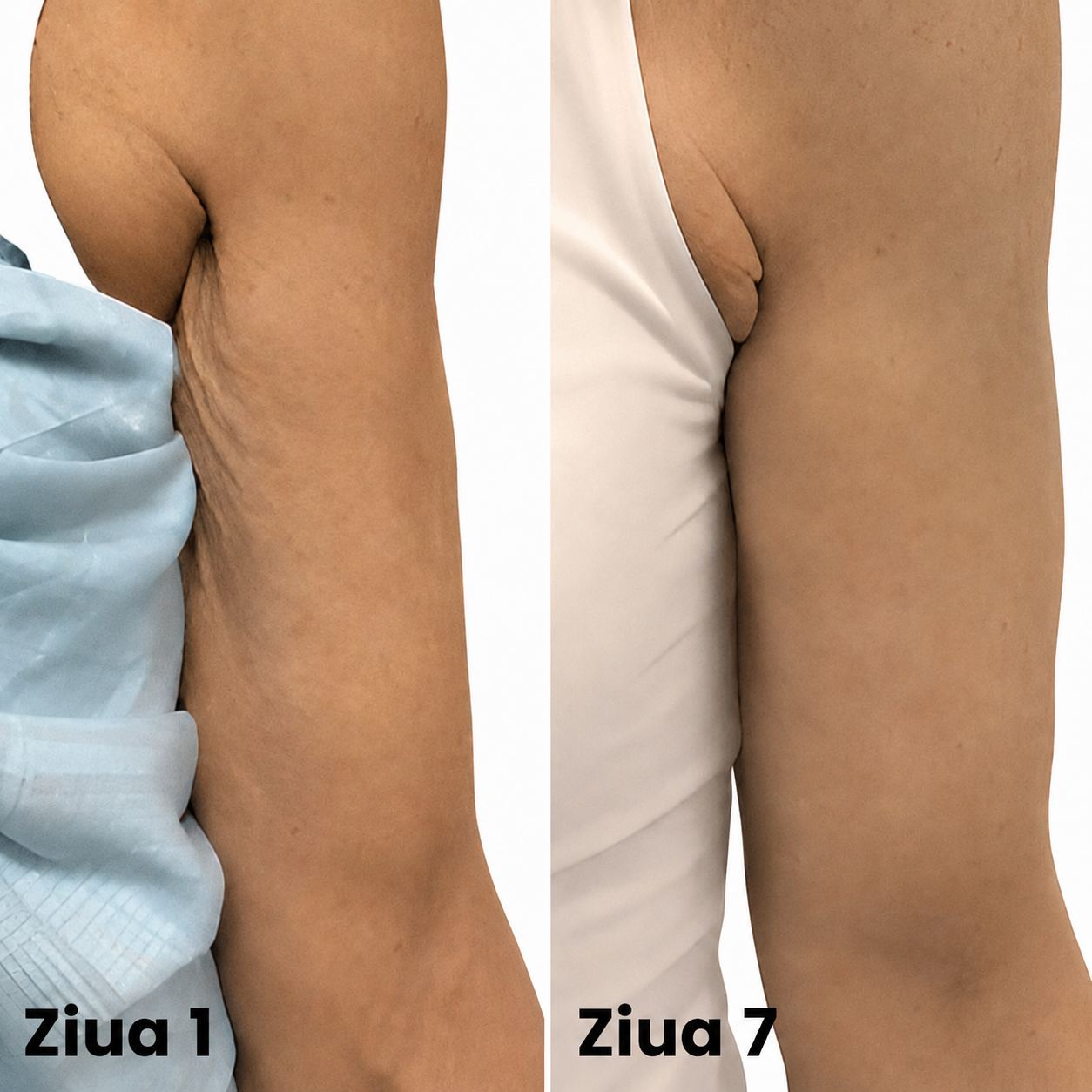 Înainte și după — ziua 1 vs ziua 7