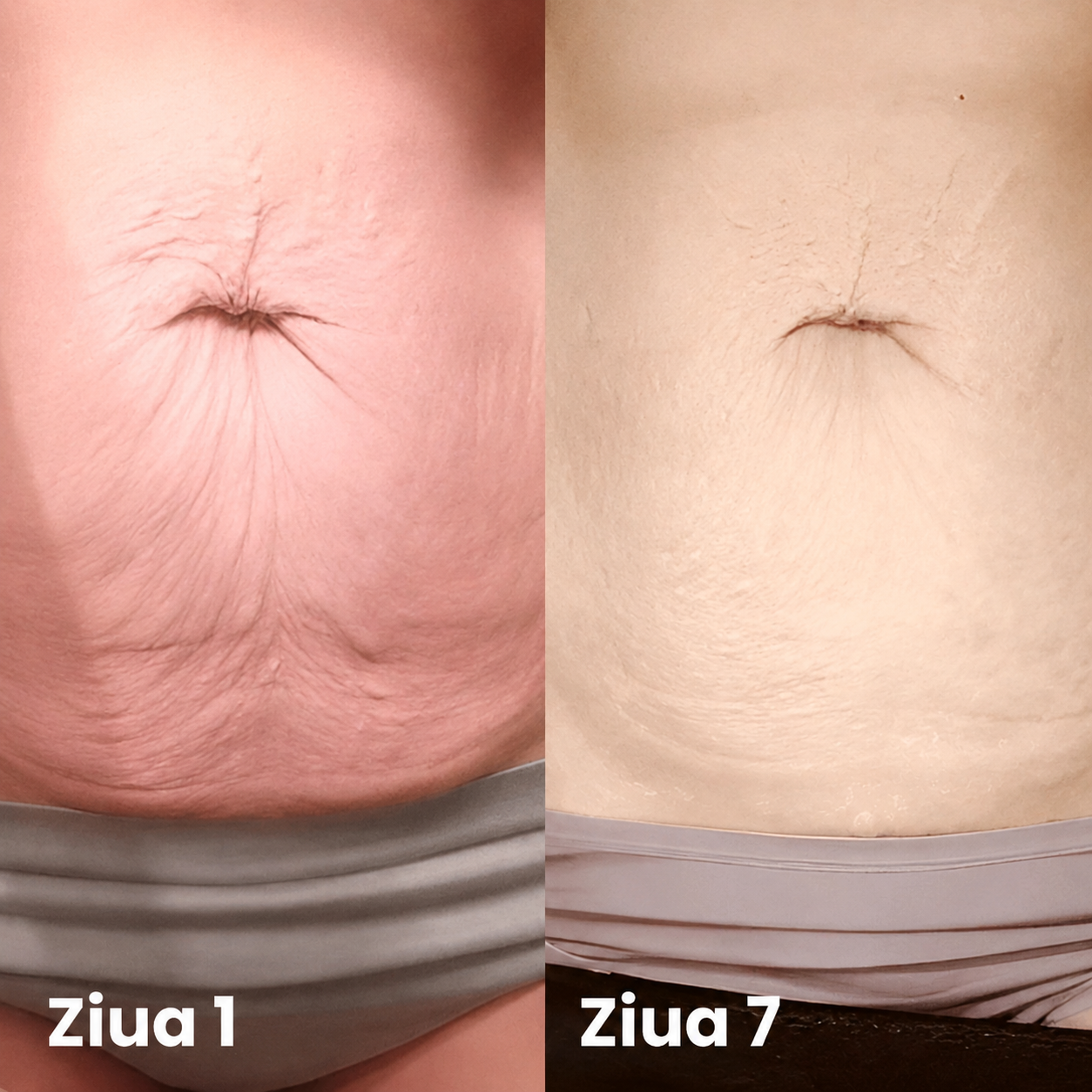 Înainte și după — ziua 1 vs ziua 7